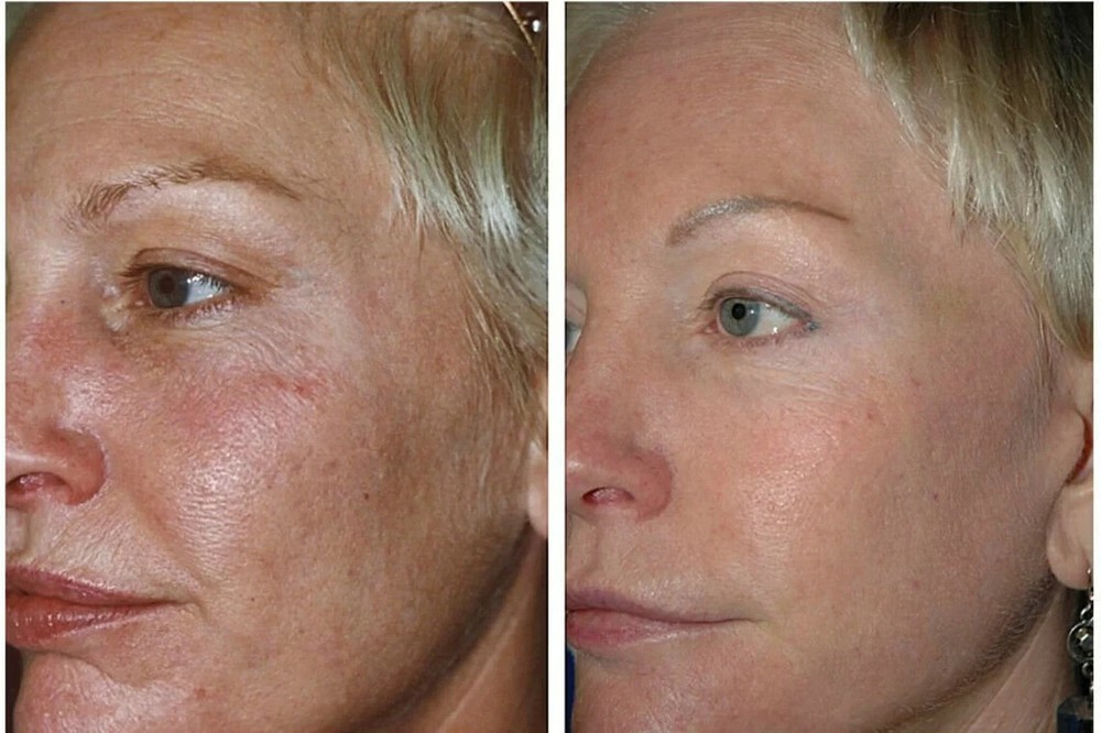 AGING SKIN Anti Aging SkinCare Kit of 9 products for Day & Night RegimeEL-image
